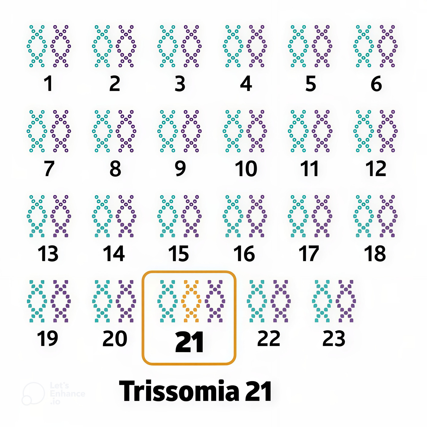 Imagem ilustrativa de um cariótipo onde há três cromossomos no 21